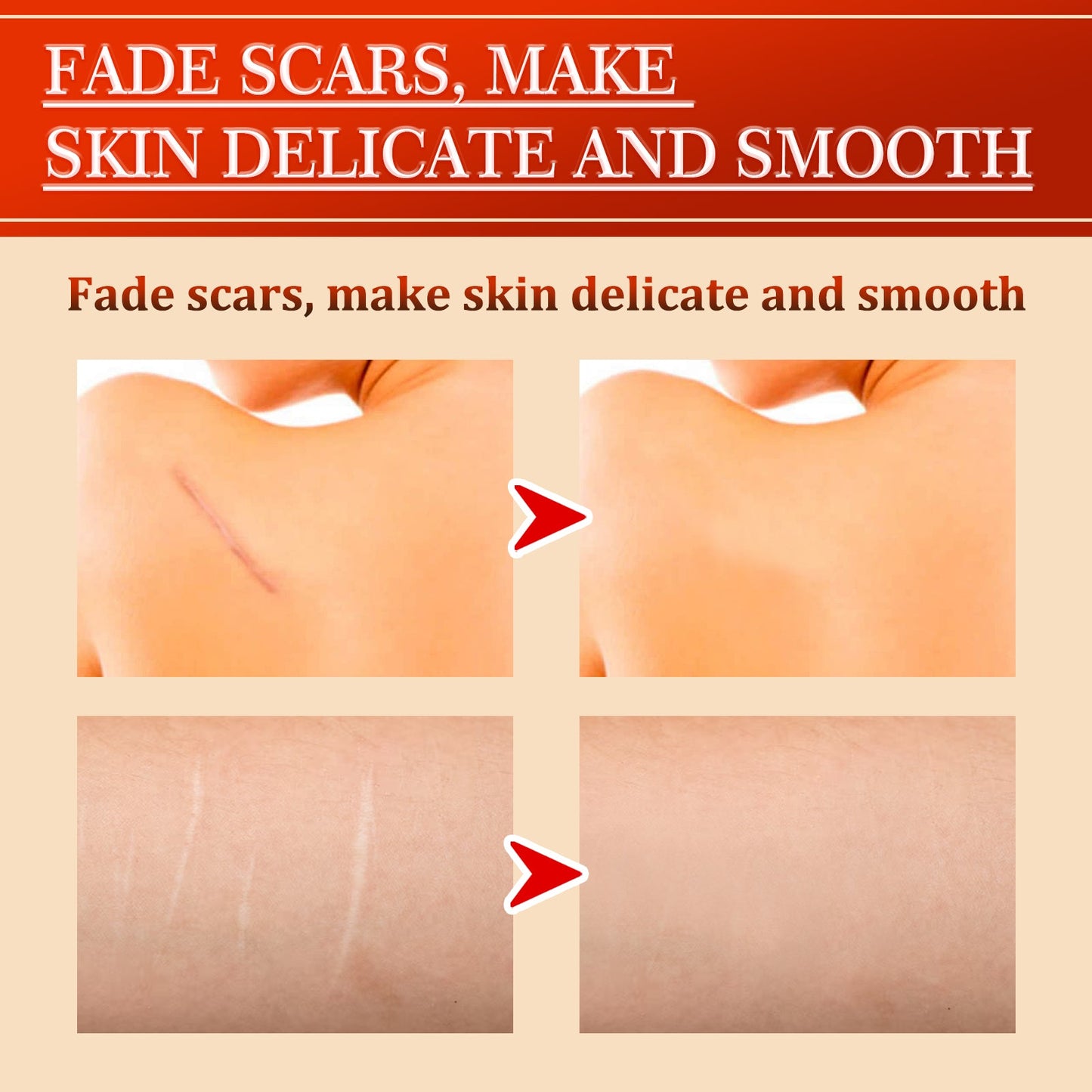 Centella Repair Scar Recovery Cream eprolo