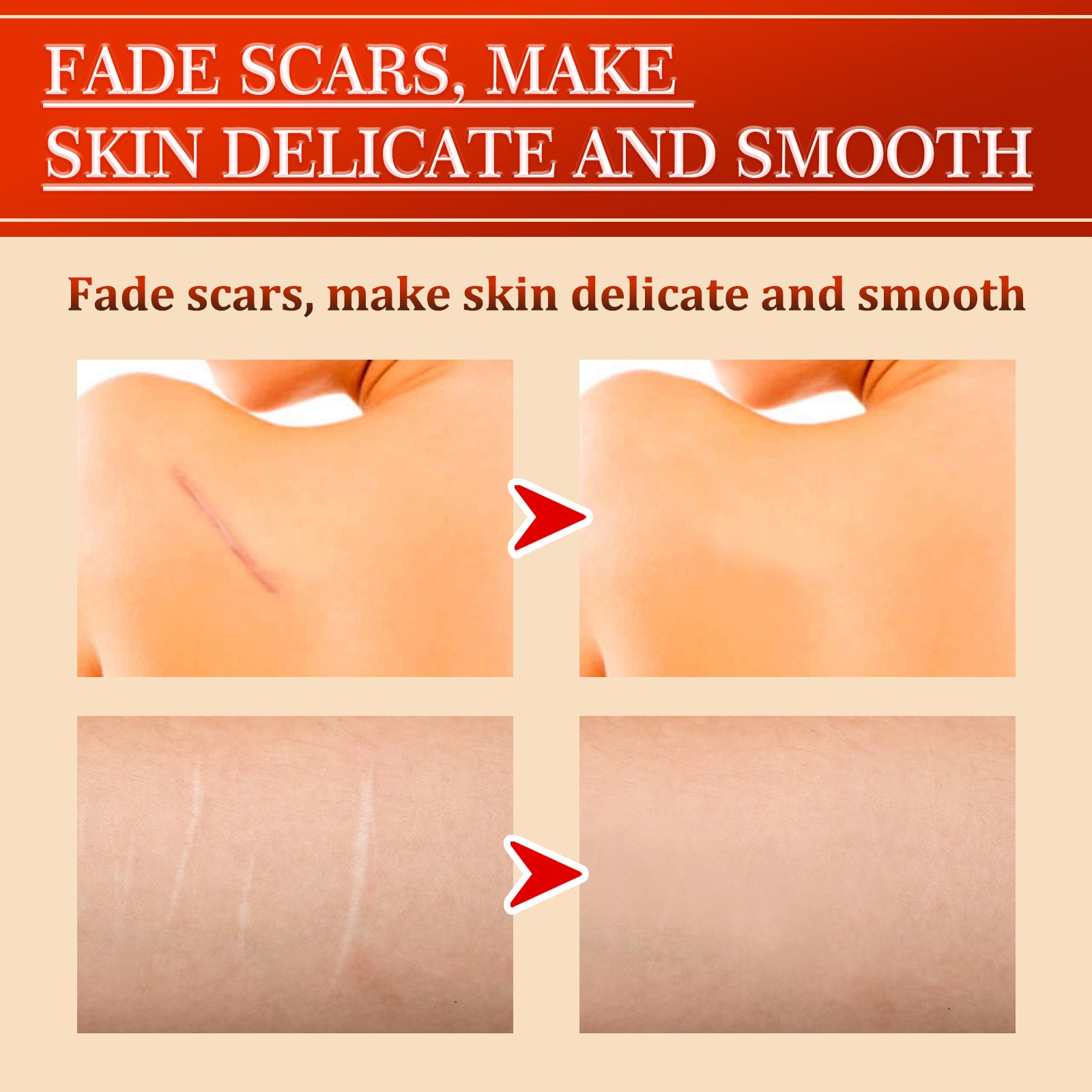 Centella Repair Scar Recovery Cream eprolo