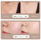 LCD dot mark pen home dot mark scanning pen laser beauty mole scanner eprolo