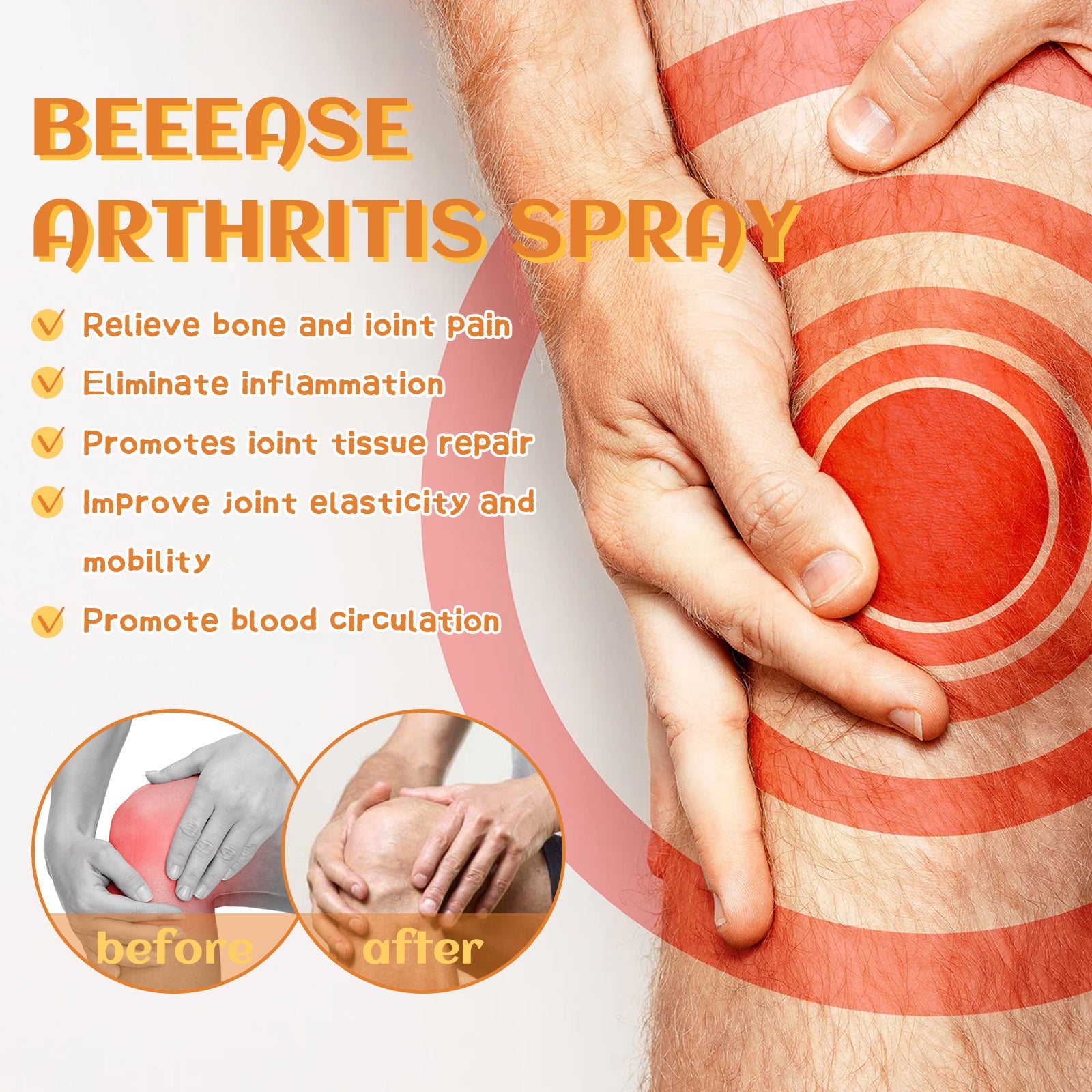 South Moon Beease Arthritis Spray, Relieve Joint Pain Shoulder Cervical Vertebra Lumbar Body Care Spray eprolo