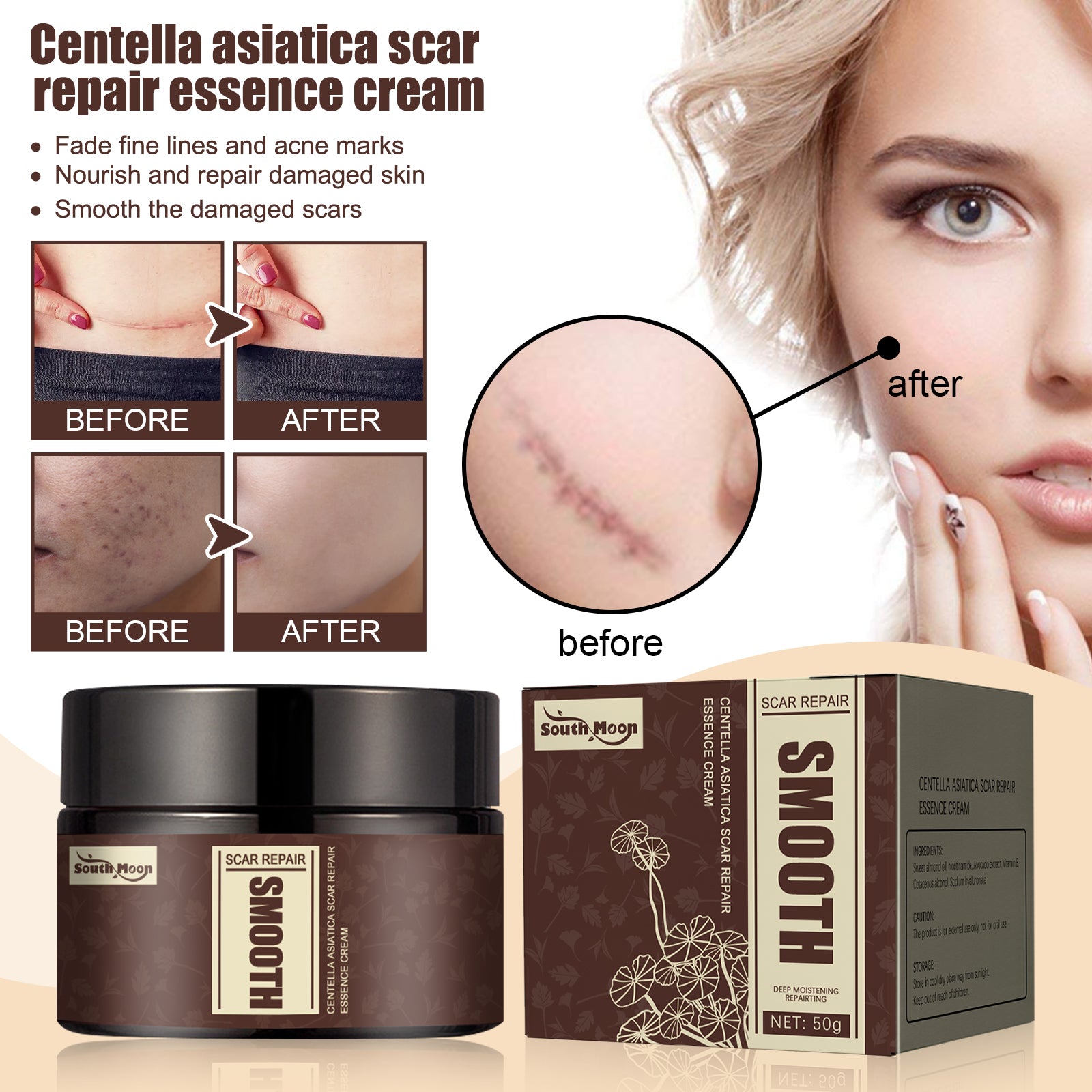 Centella Repair Scar Recovery Cream eprolo